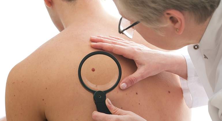 Dermatologa-mirando-un-lunar-iStock.jpg