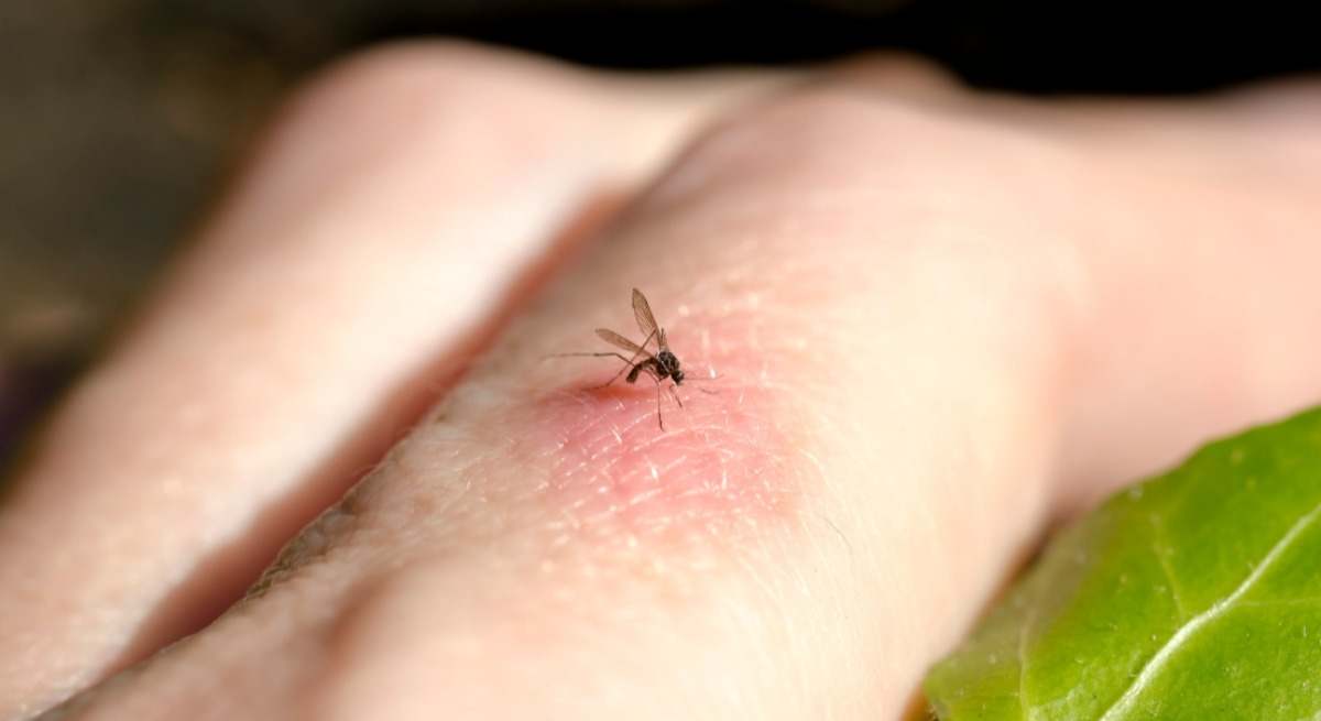 Los alimentos del verano que ayudan a evitar las picaduras y alejar a los mosquitos.