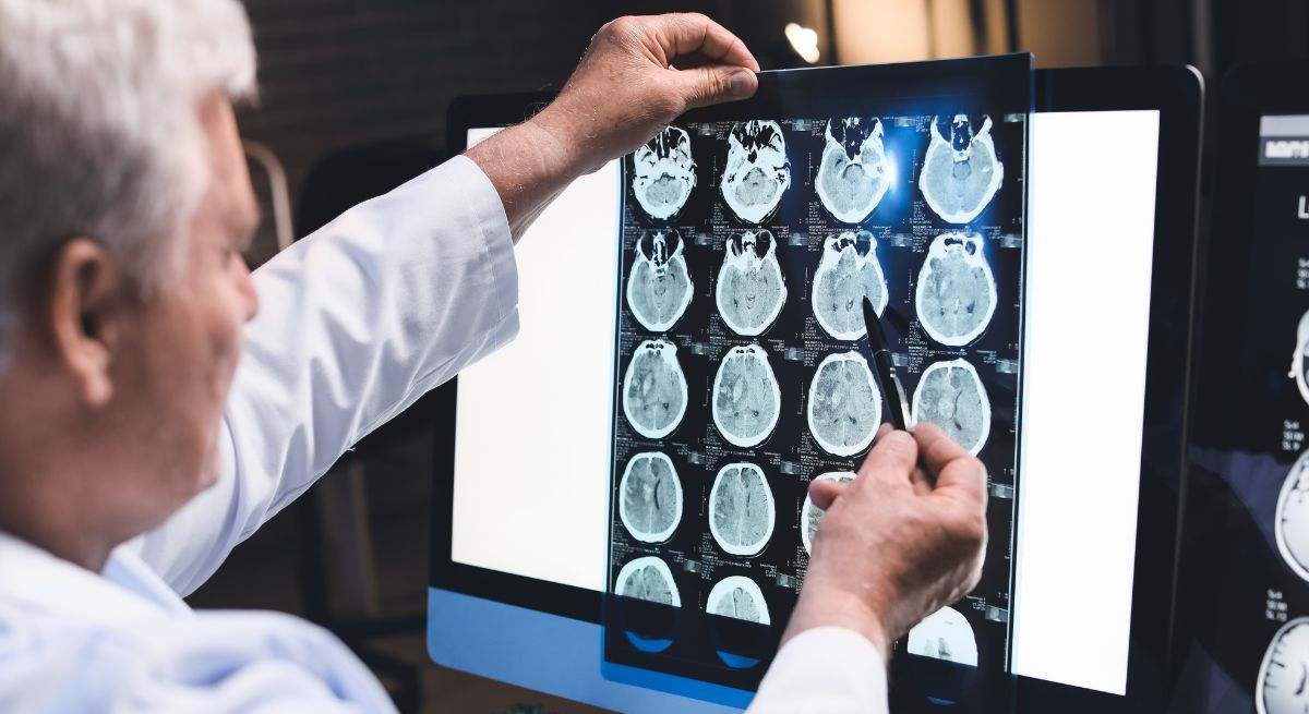 Neurólogo