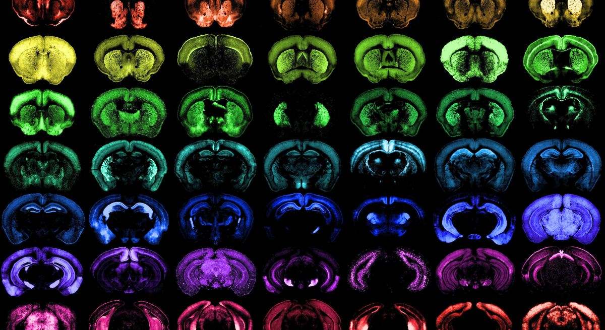 Diferentes grupos de células en el cerebro