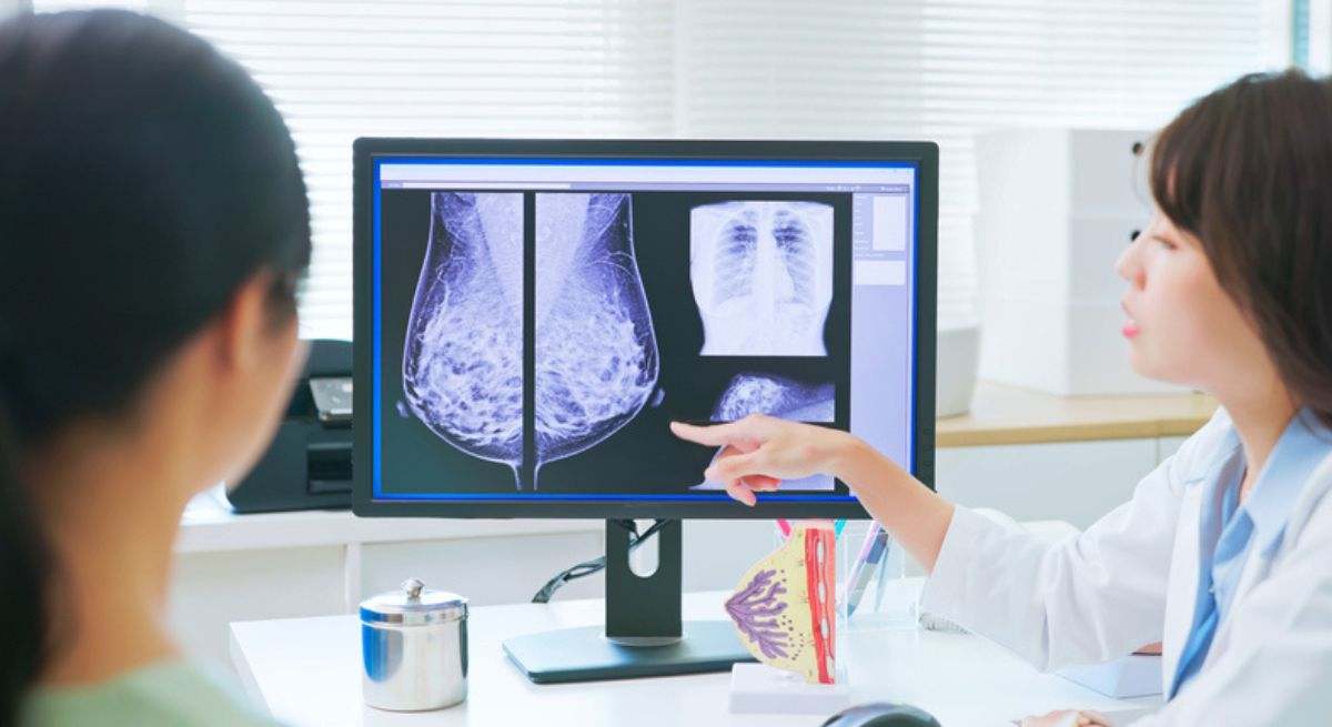 Médica explicando los resultados de una mamografía