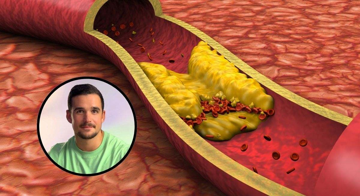 Juan Bola, nutricionista, junto con una ilustración de colesterol