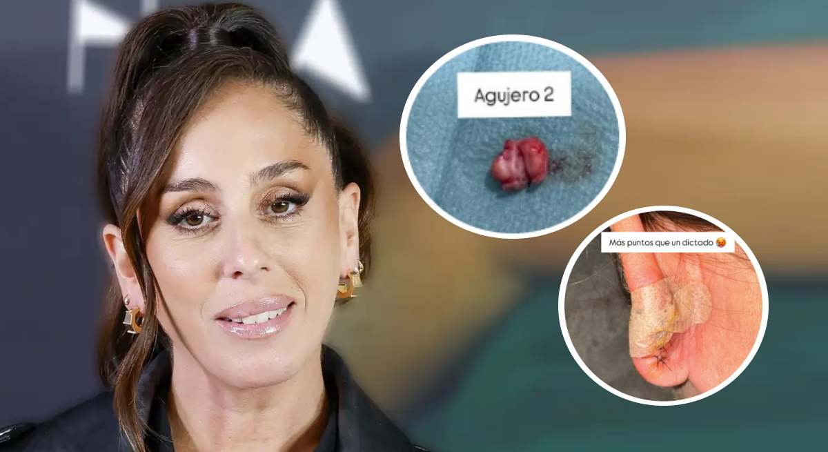 Anabel Pantoja quiste