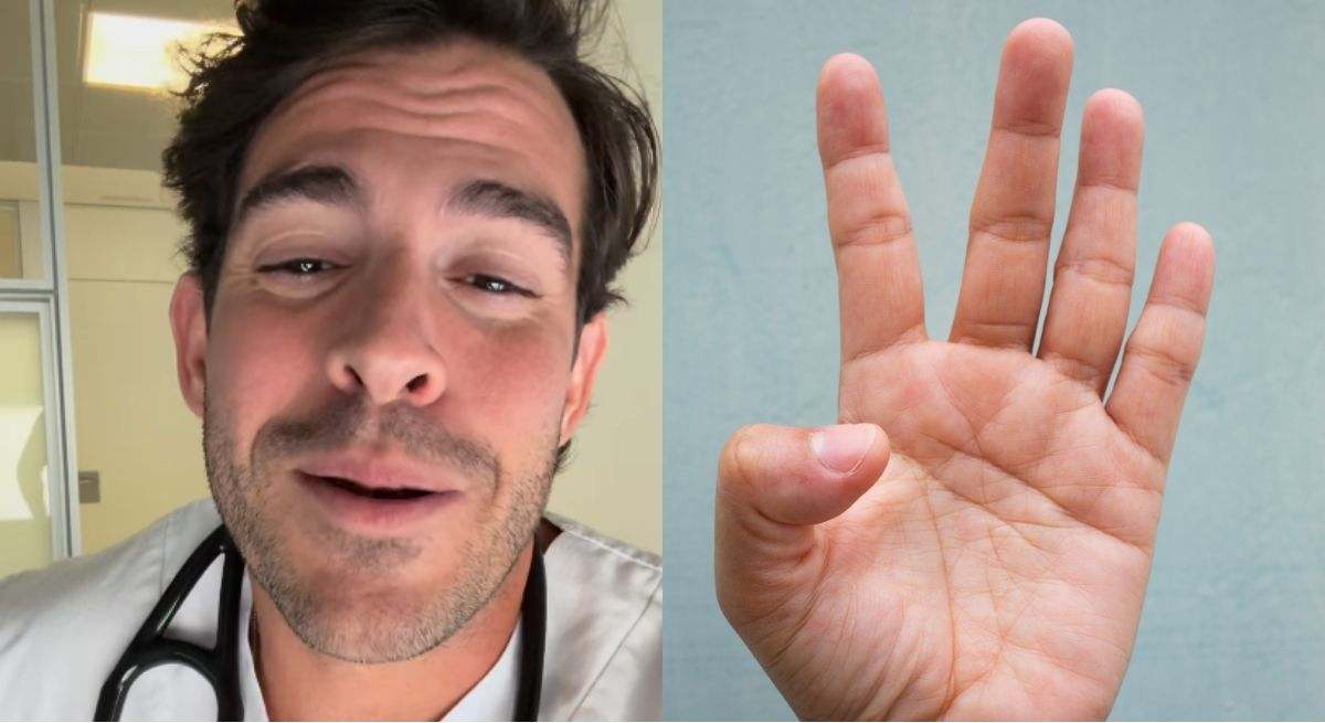 Aurelio Rojas junto con la imagen de una palma de la mano abierta