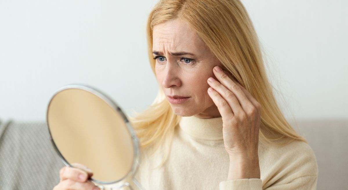 Una mujer, preocupada por las arrugas de su rostro 