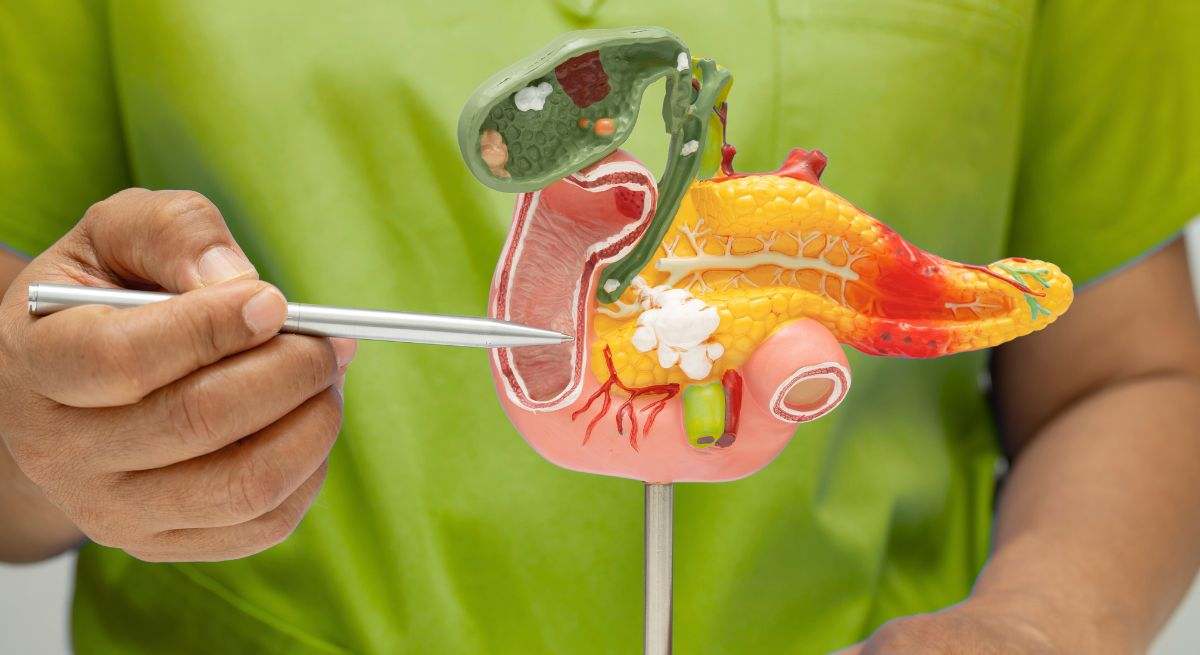 Cáncer de páncreas