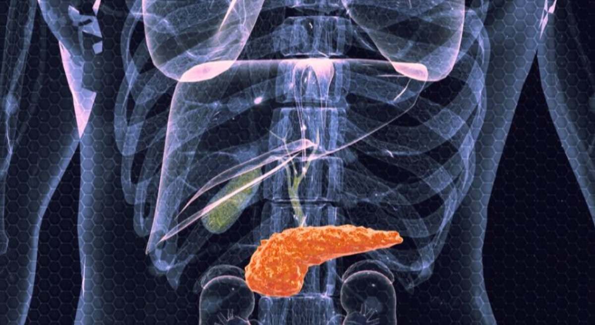 El cáncer de páncreas es uno de los tumores más agresivos del tracto digestivo