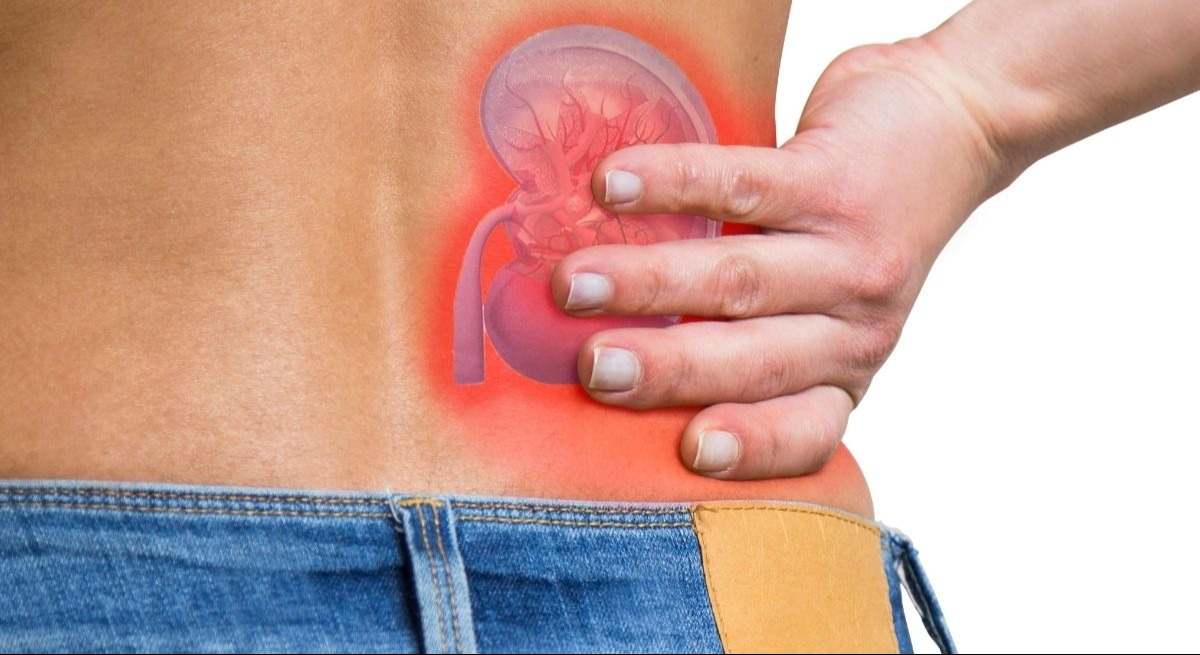 dano-renal-canva