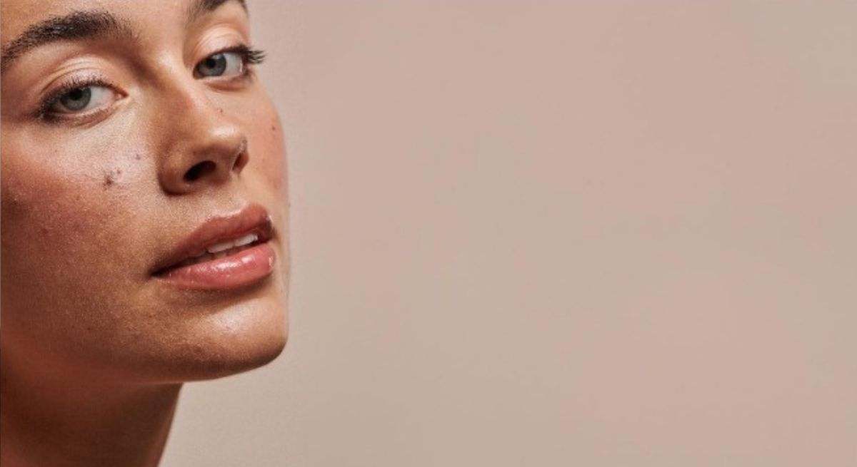 acne-1200--.jpg