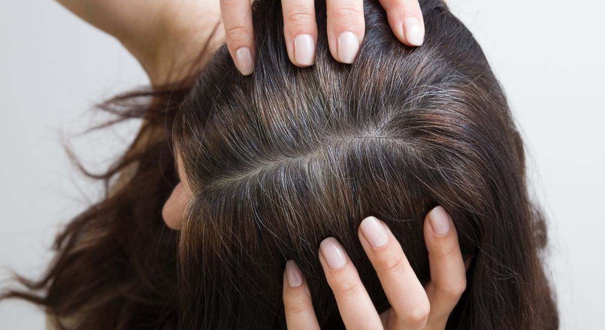 Las canas son señal de envejecimiento capilar