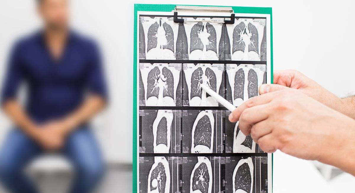 Ecografía pulmonar