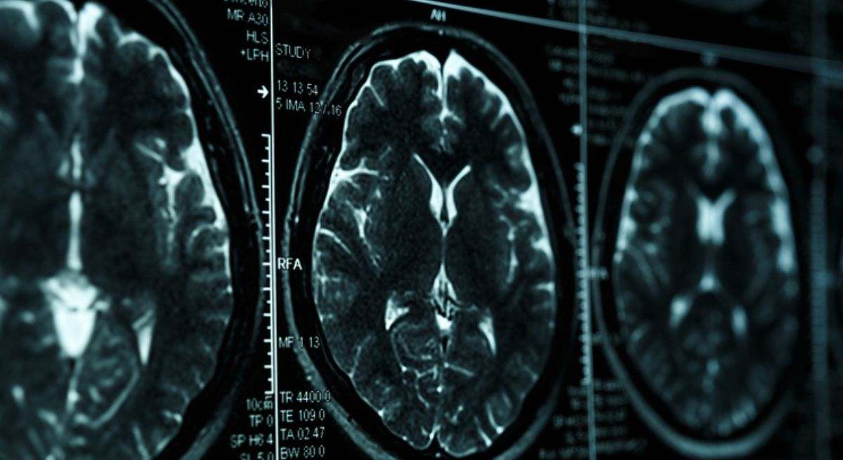 Un estudio revela que la inmunoterapia pre y postcirugía mejora resultados en cáncer de cabeza y cuello