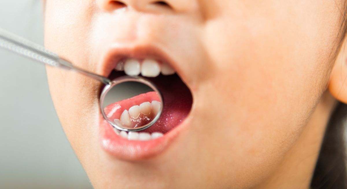 Dientes de leche