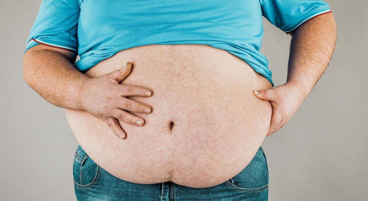 La obesidad es la enfermedad nutricional más frecuente de los países desarrollados