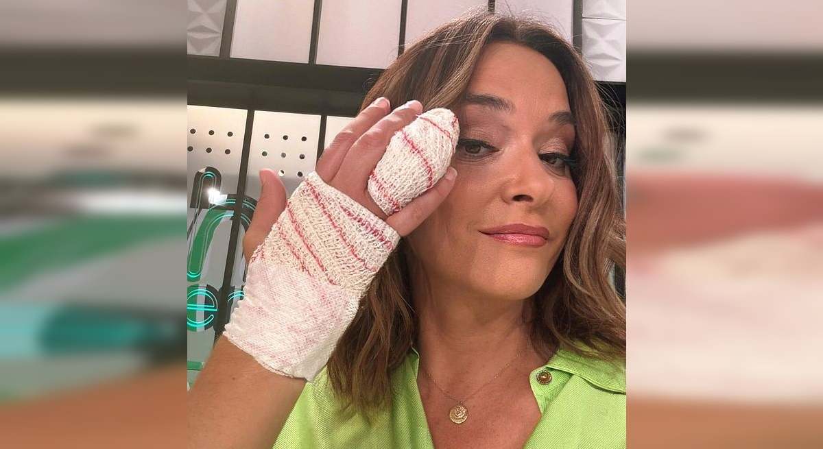 Toñi Moreno dedo 
