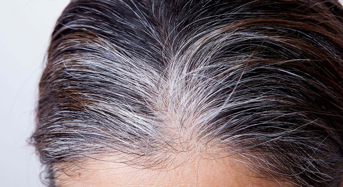 Las canas son cabellos que se vuelven de color gris o blanco debido a una pérdida de pigmentación