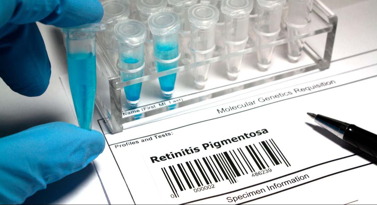 El trastorno que más gente padece es la retinosis pigmentaria