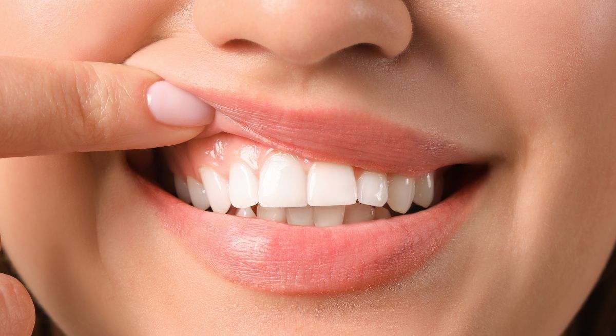 Sonrisa de una chica con los dientes muy blancos