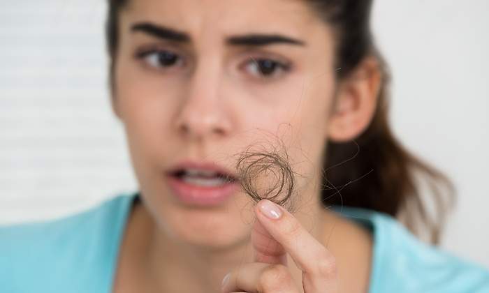 perdida-pelo.jpg
