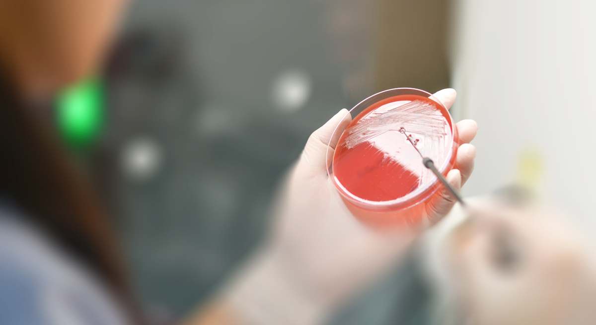 resistenciaantimicrobiana