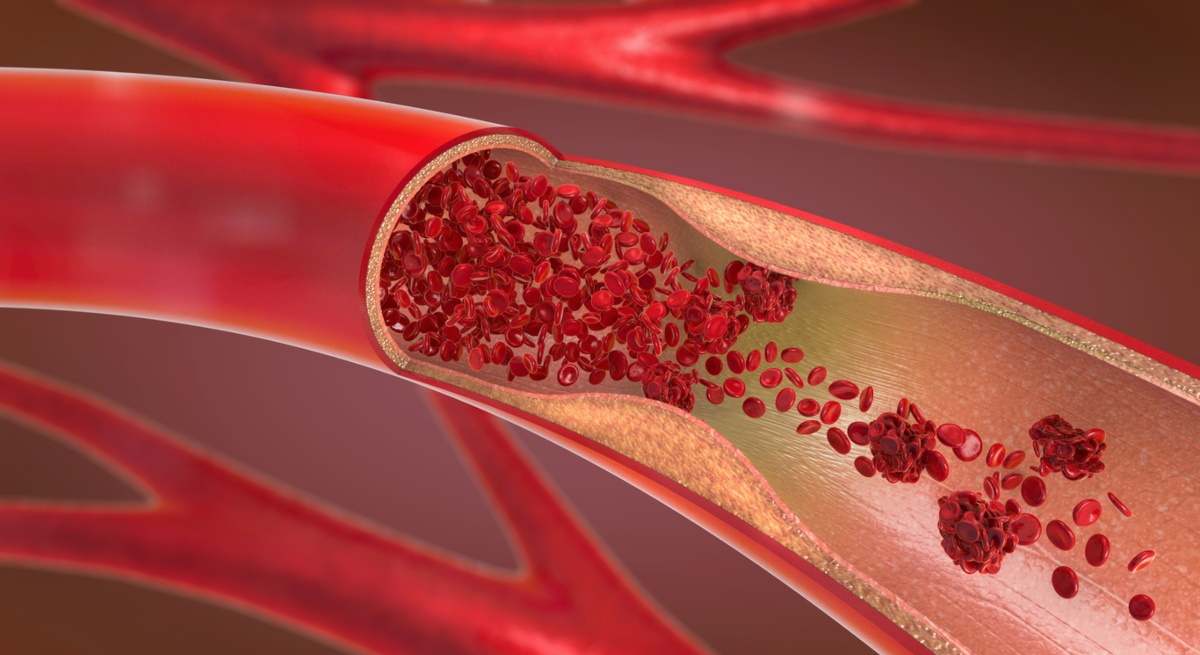 colesterol-sangre-venas-istock.jpg