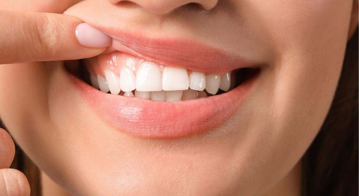 Una mujer enseña sus dientes blancos ante la cámara 