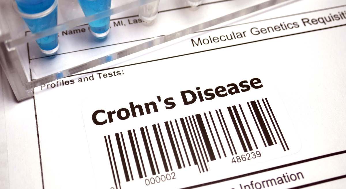 Enfermedad del Crohn