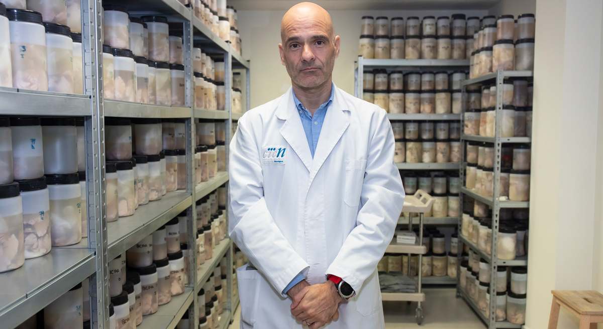 Pascual Sánchez-Juan, director científico de la Fundación Centro de Investigación de Enfermedades Neurológicas (CIEN)