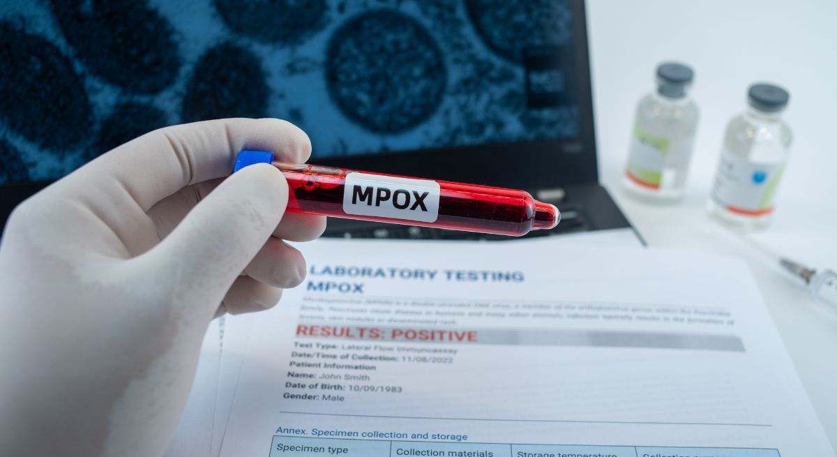 Mpox, salud