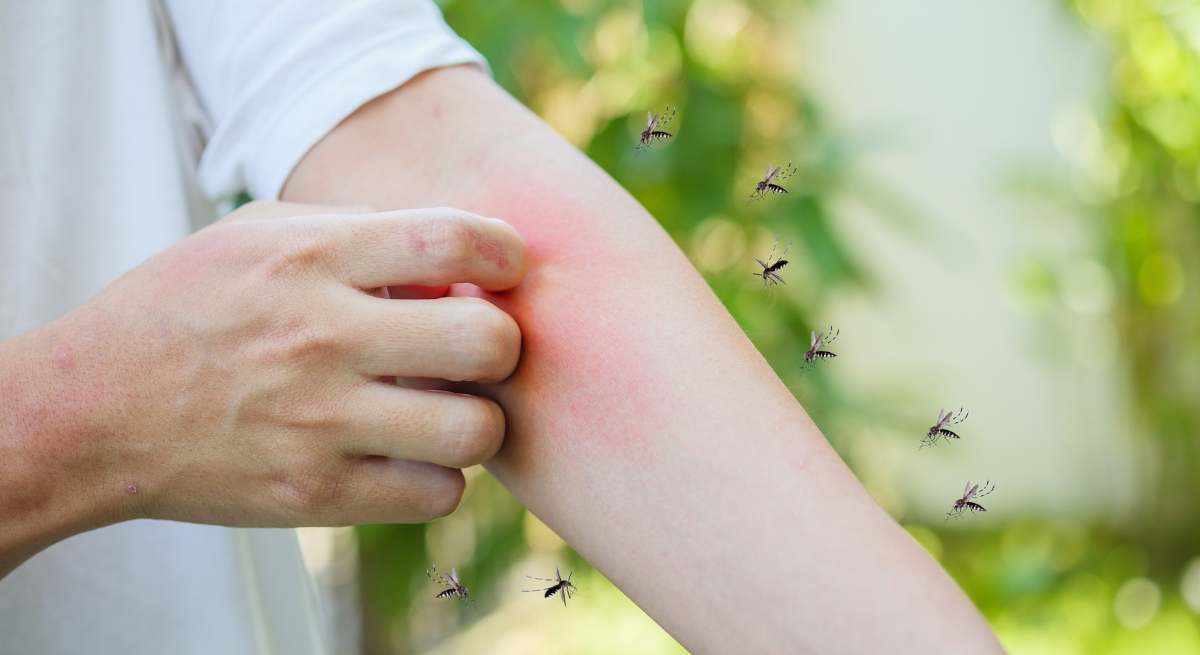 Olvídate de las picaduras de mosquitos este verano.