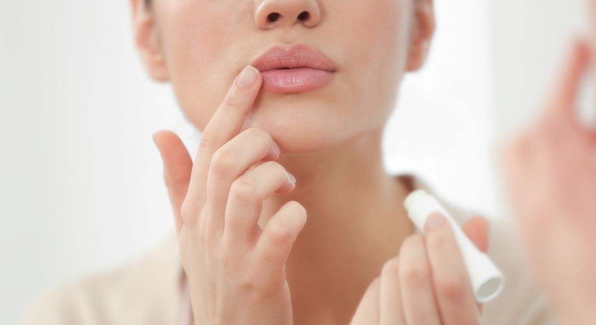 Melasma Labios