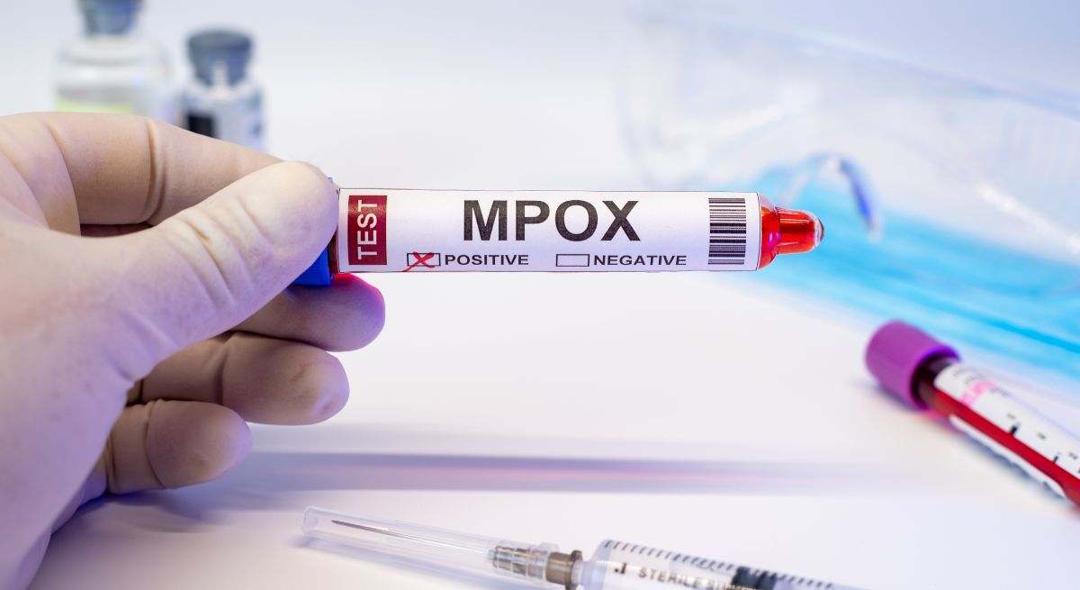 La viruela del mono (MPX) es una enfermedad vírica zoonótica causada por el virus de la viruela del mono (MPXV)