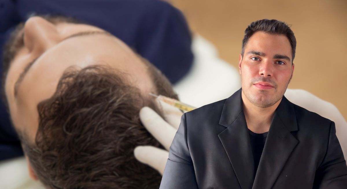 Tricotilomanía dermatólogo