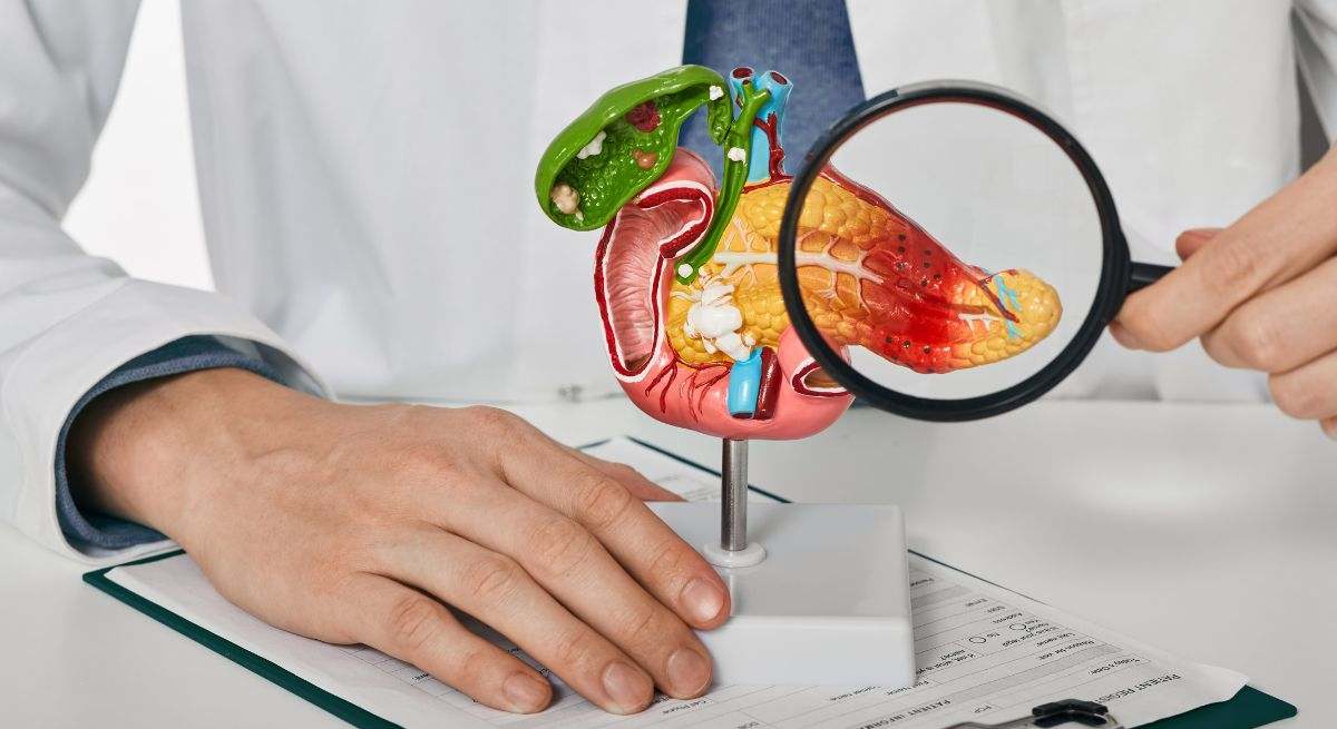 Cáncer de páncreas