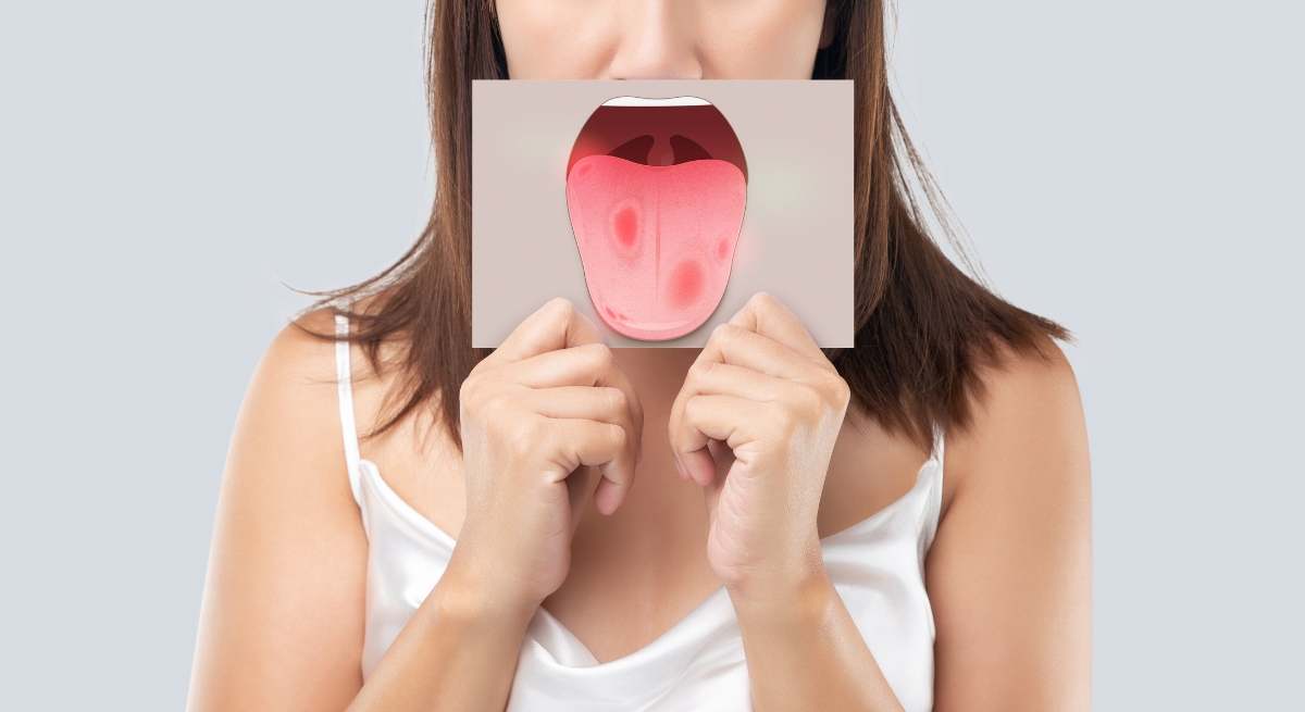 Por qué pica la boca después de comer frutas.