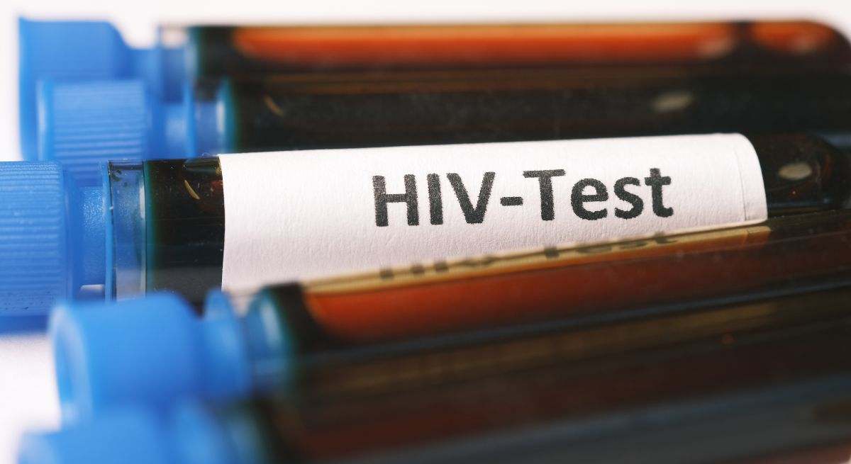 Se trata de un virus que ataca al sistema inmunitario humano