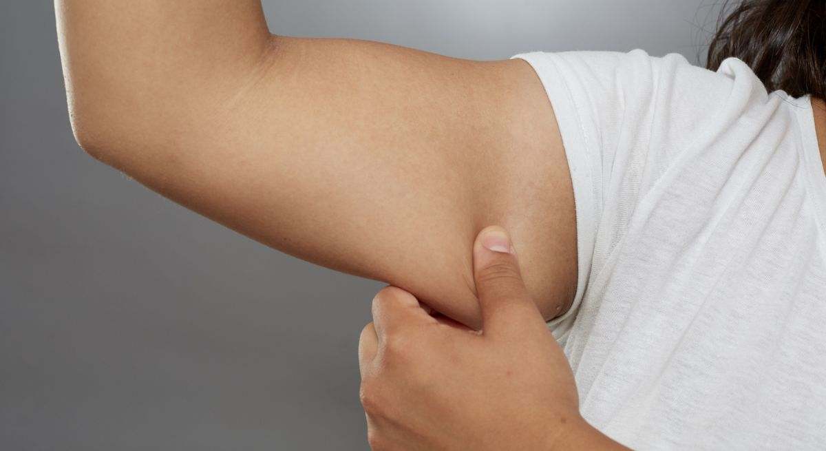 Mujer pellizcando uno de sus brazos
