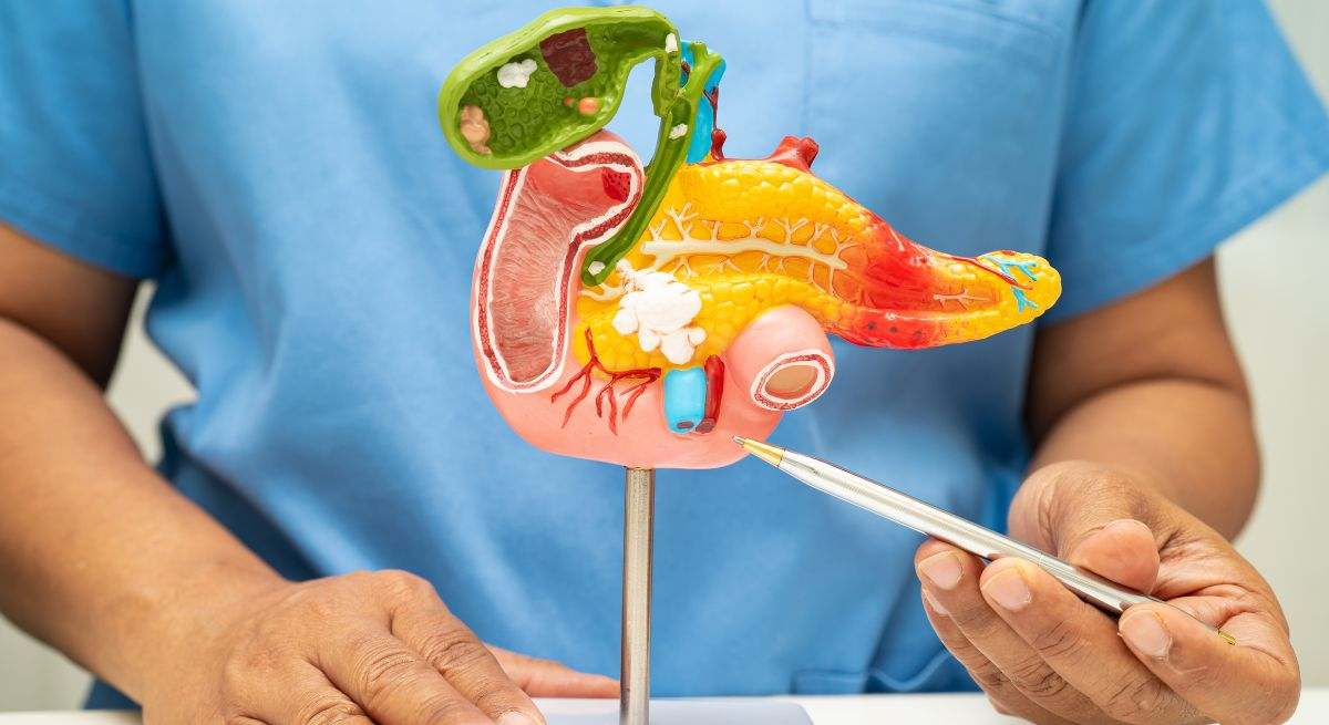 Cáncer de páncreas