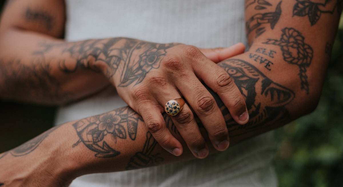 Láser para eliminar tatuajes.