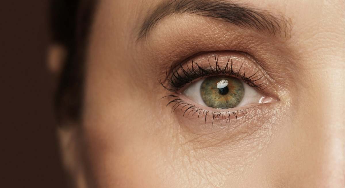 ojeras-y-arrugas