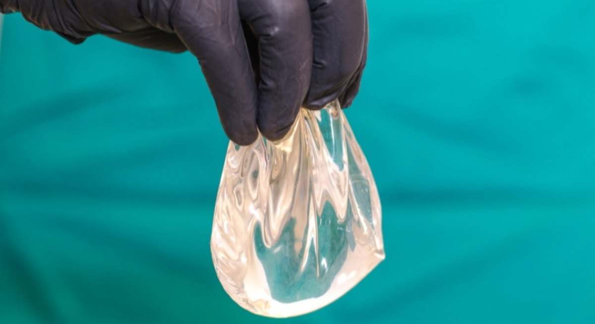 Extracción de implantes mamarios.