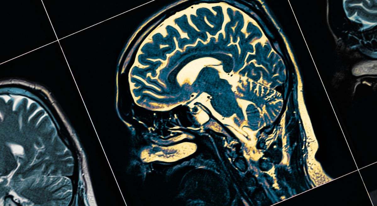 Revierten los efectos del Parkinson en ratones: modelos experimentales allanan el camino para la investigación en humanos