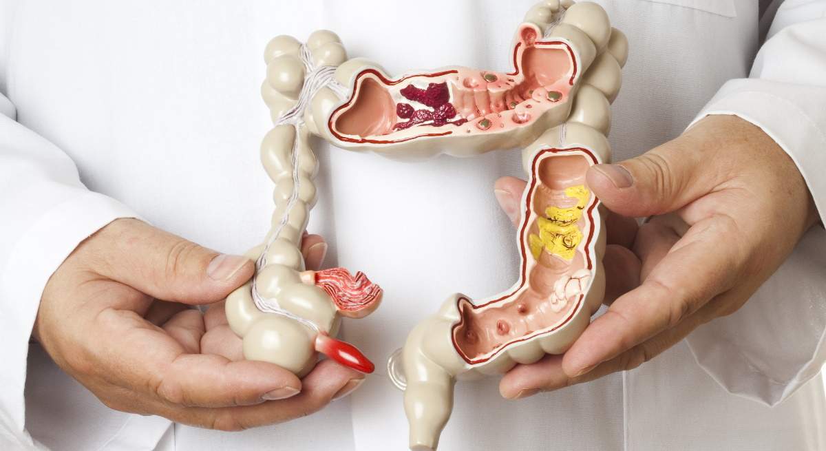 colon.jpg