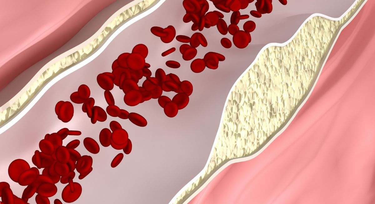 Nivel de azúcar en sangre