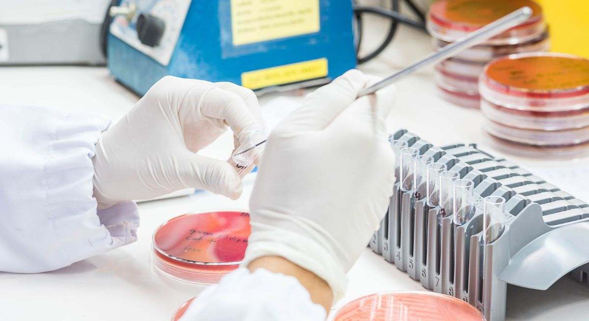España cuenta con el Plan Nacional frente a las Resistencias a los Antimicrobianos (PRAN).