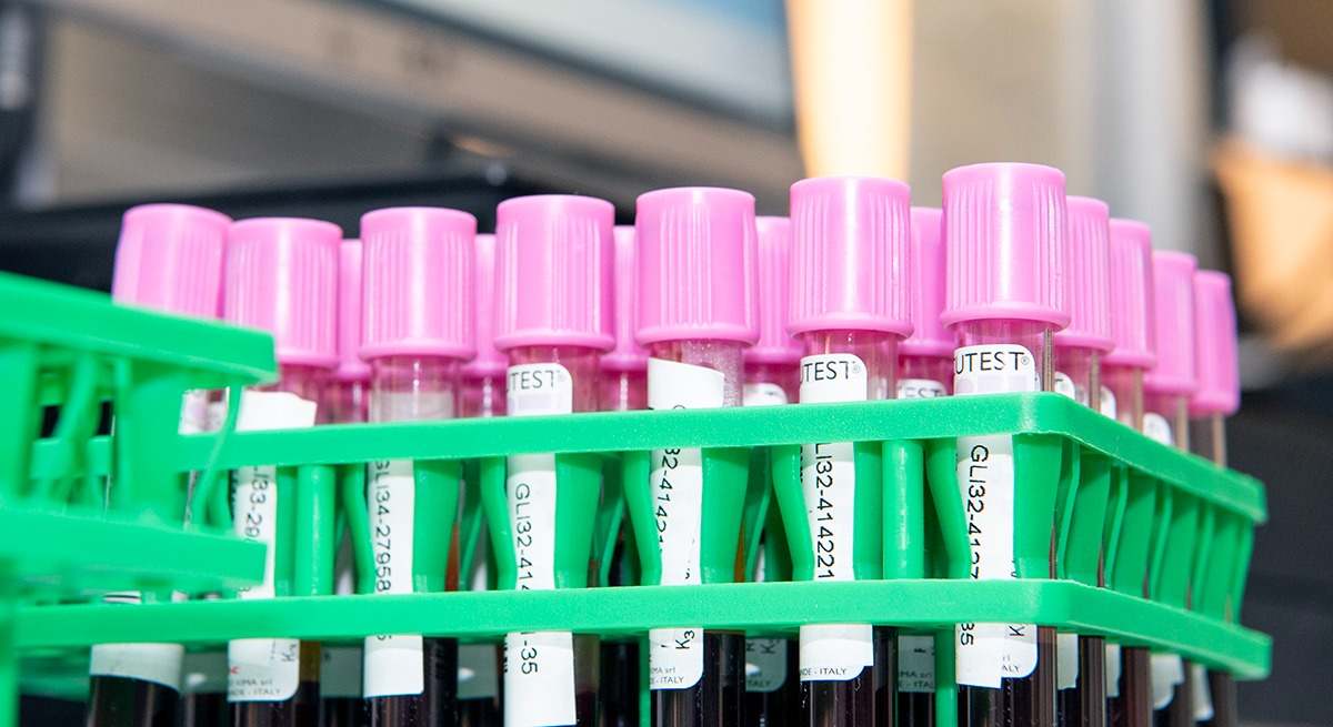 La 'Hb A2-Getafe', variante de la hemoglobina clave para identificar enfermedades hereditarias de la sangre