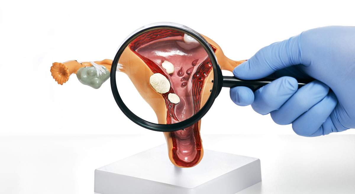 INFECCIONES-VAGINALES.jpg
