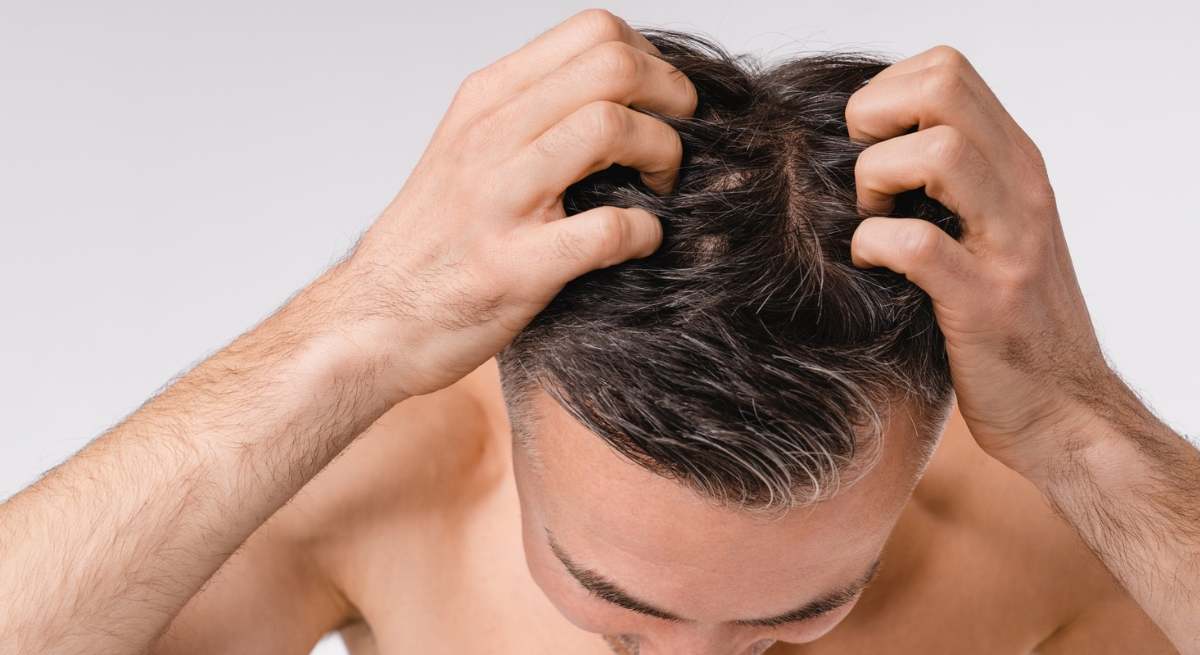 pelo-hombre