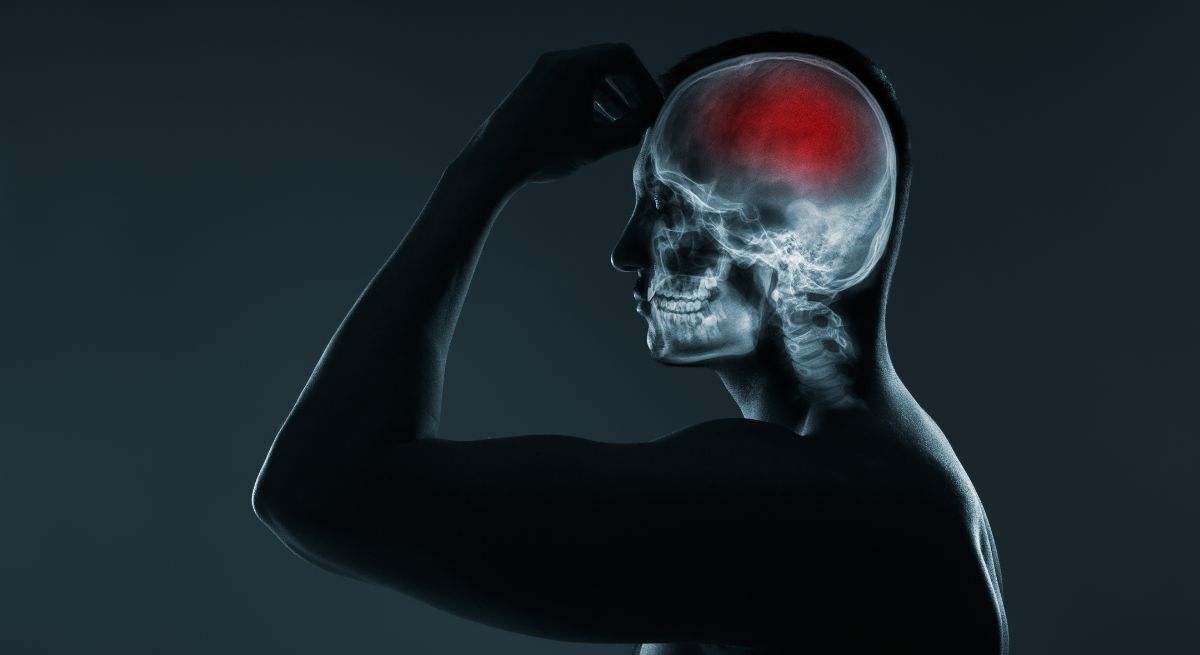 Es un accidente cerebrovascular que se caracteriza por instaurarse de forma brusca