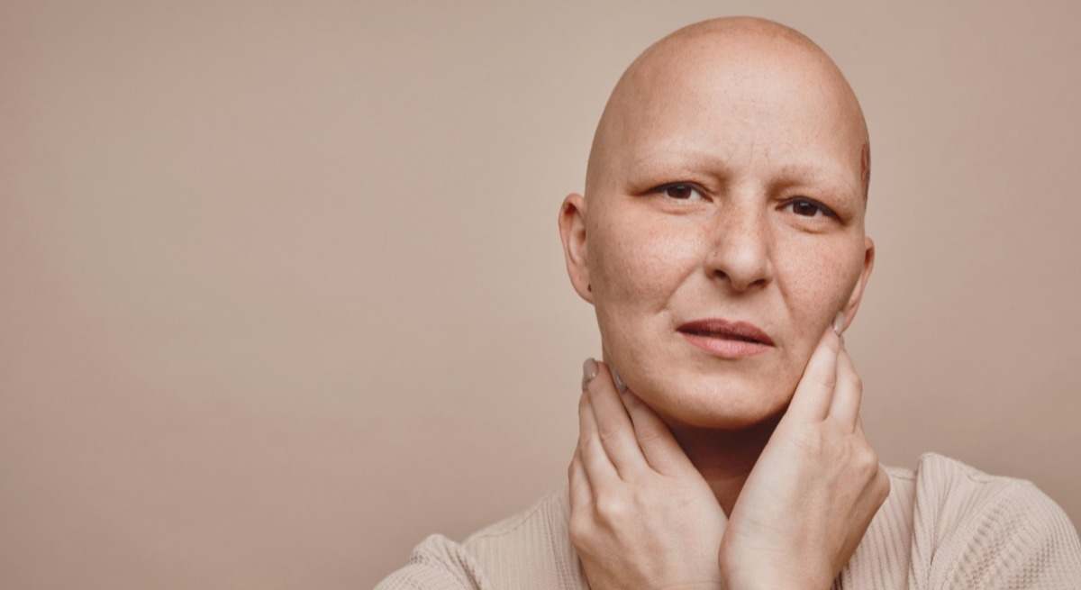 La alopecia femenina, tan desconocida como común.